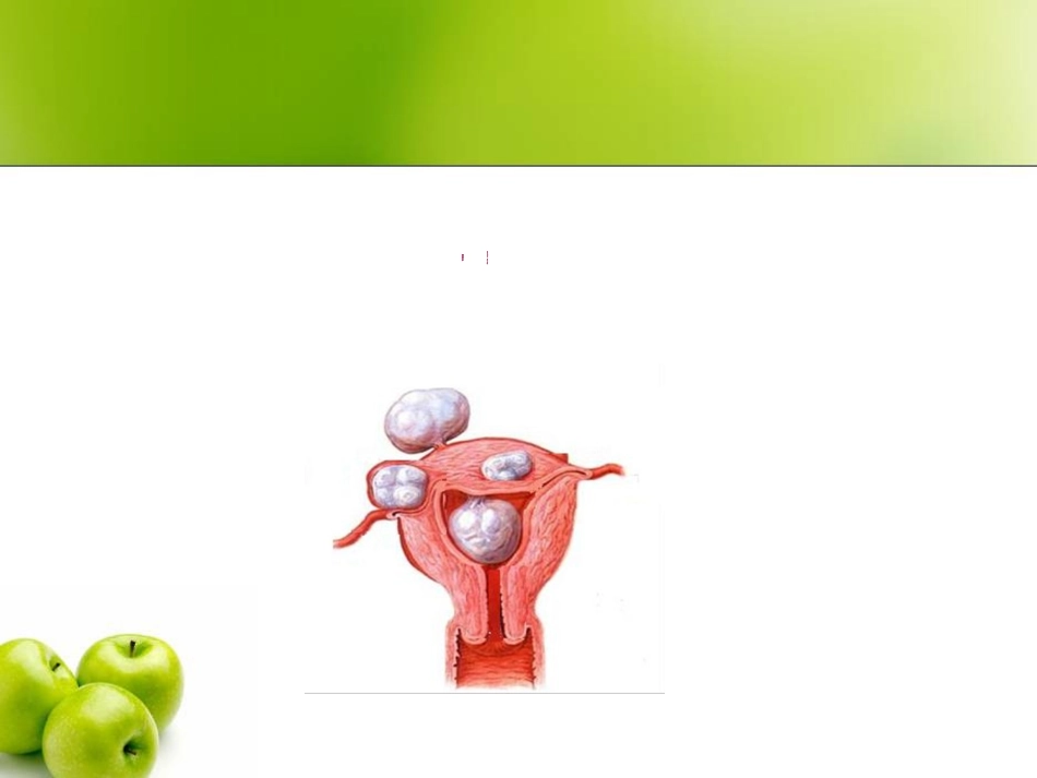 子宫肌瘤英语课件_第1页