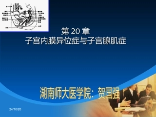 子宫内膜异位症版