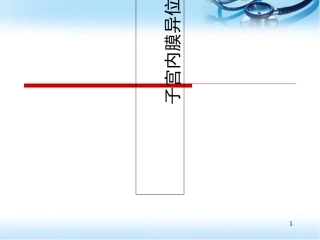 子宫内膜异位症课堂