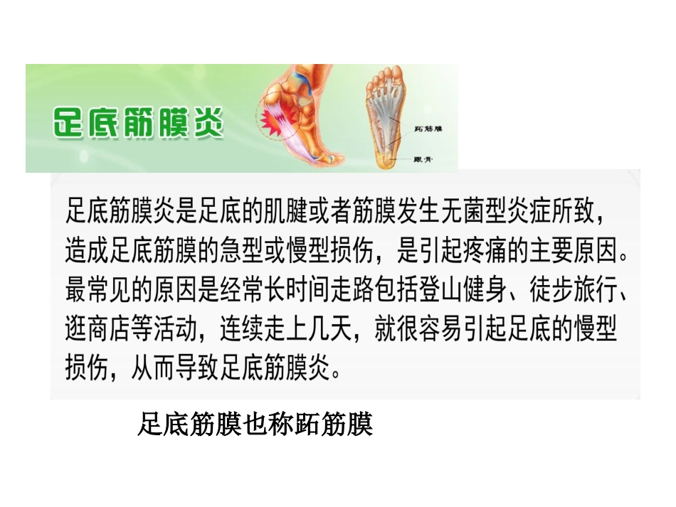 足底筋膜炎的康复_第2页