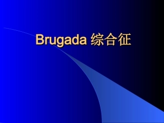 Brugada综合征