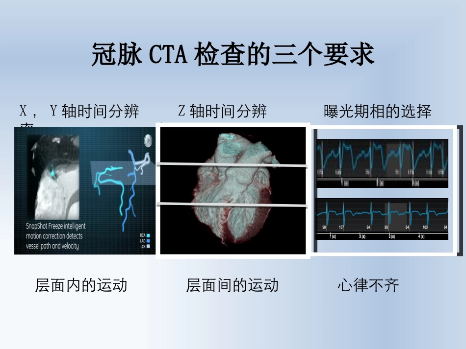 CT冠状动脉成像技术_第3页