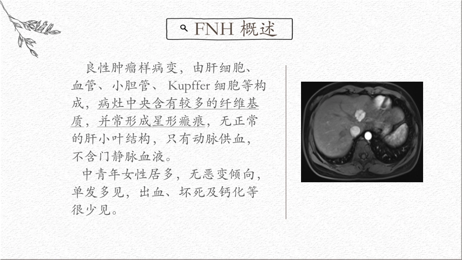 FNH影像表现_第2页