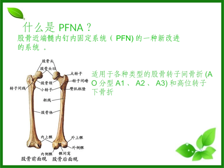 PFNA髓内钉手术配合护理查房_第2页