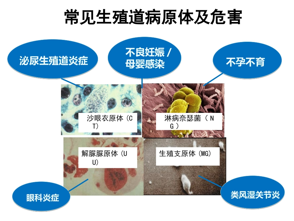 rna检测技术在生殖道病原体诊疗中的应用检验科_第2页