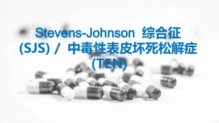 StevensJohnson综合征及中毒性表皮坏死松解症
