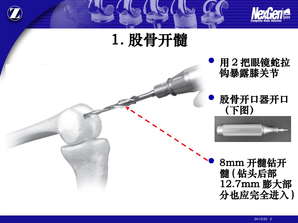 ZIMMER膝关节置换操作流程资料_第2页