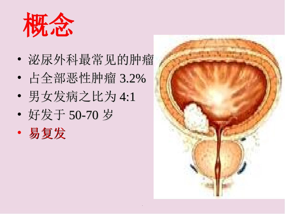 膀胱灌注医学课件_第3页