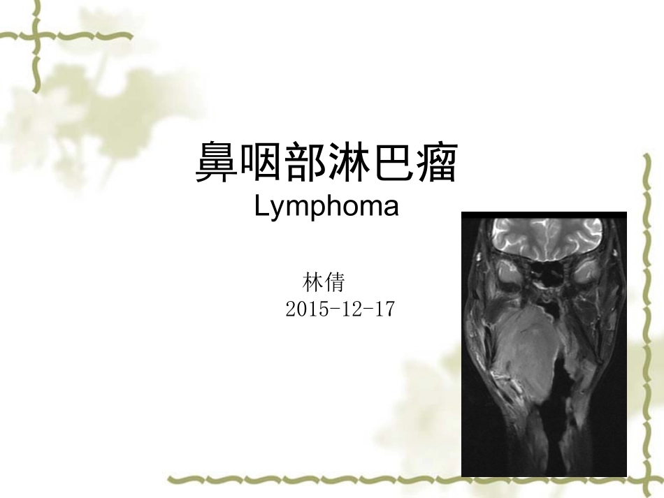 鼻咽部淋巴瘤_第1页