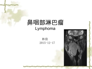 鼻咽部淋巴瘤