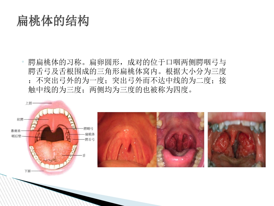 扁桃体相关解剖及扁桃体切除术讲解_第3页
