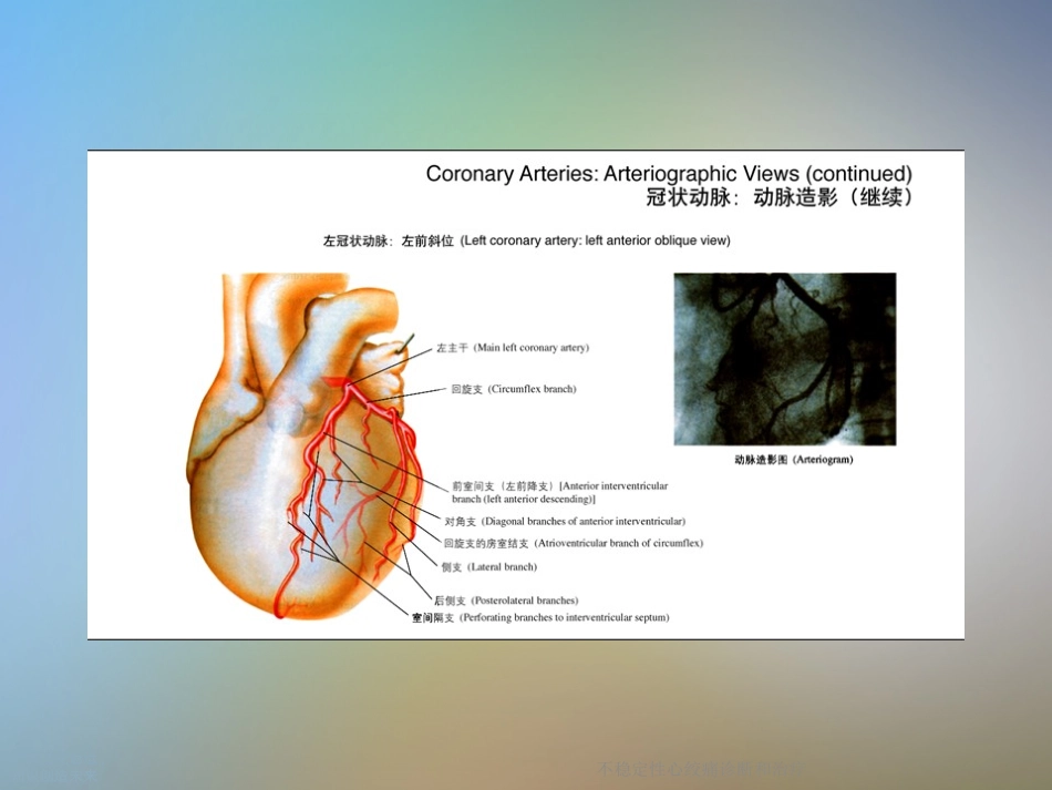 不稳定性心绞痛诊疗和治疗_第2页