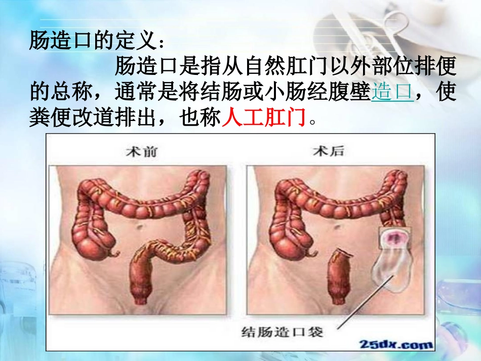 肠造瘘口的护理_第2页