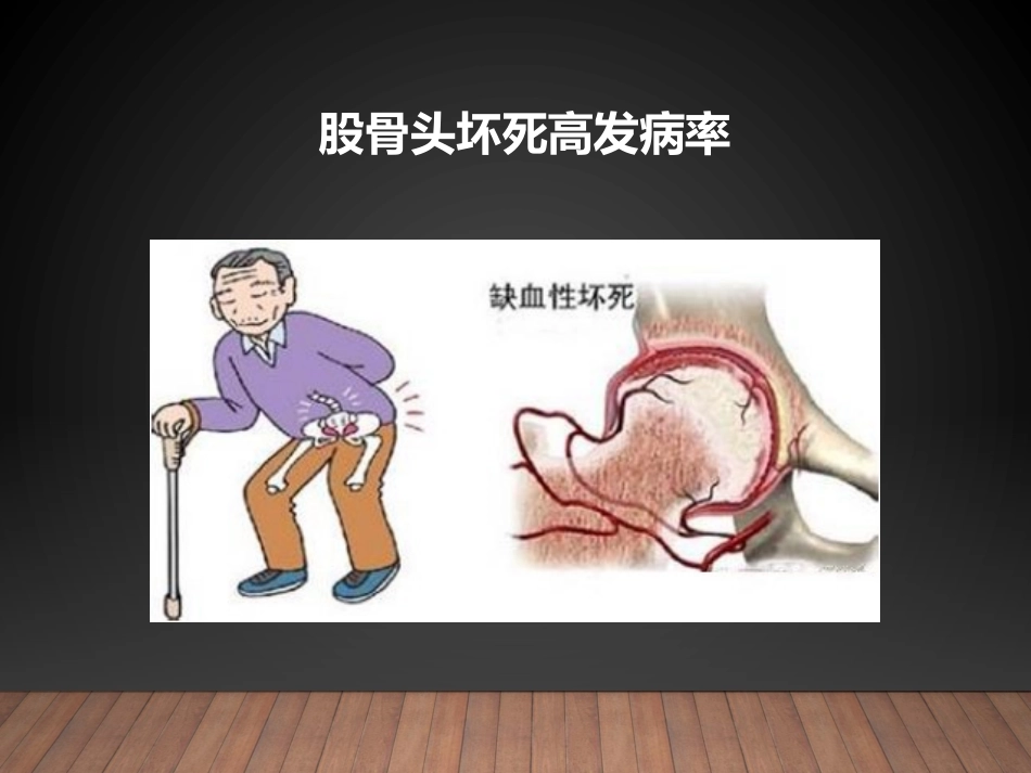 冲击波疗法治疗股骨头坏死_第2页