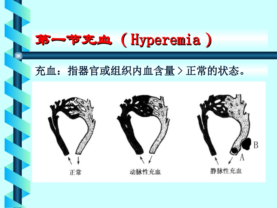 充血出血课件_第3页