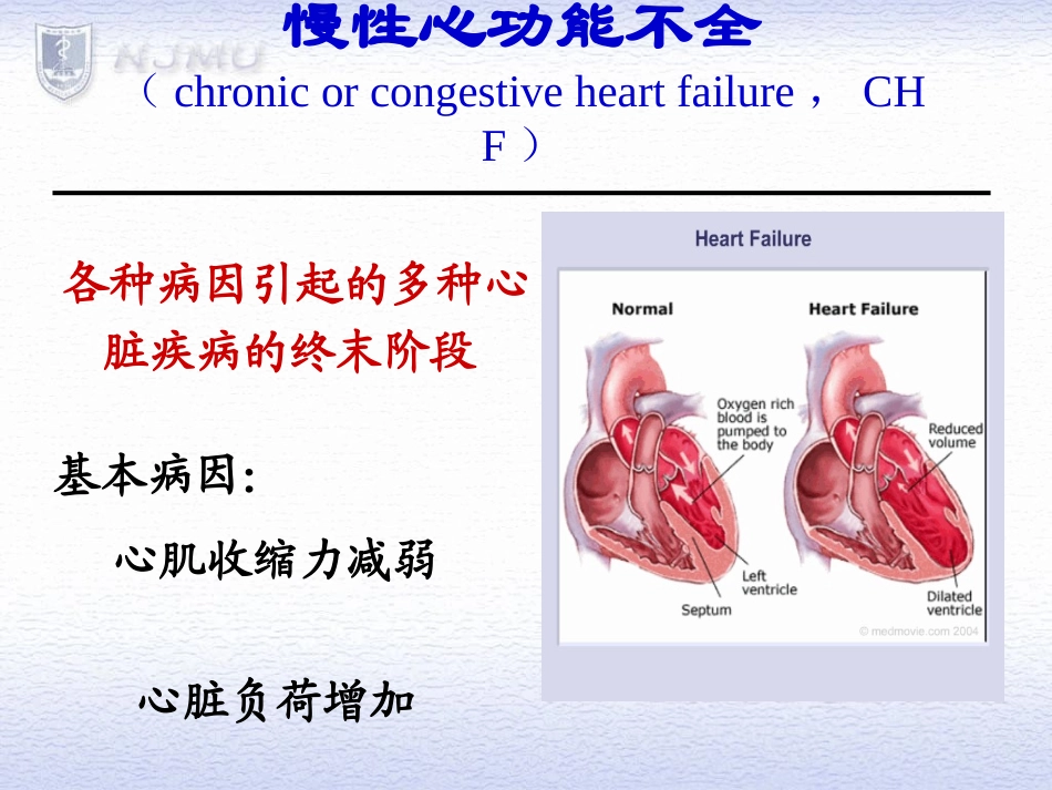 充血性心力衰竭_第2页