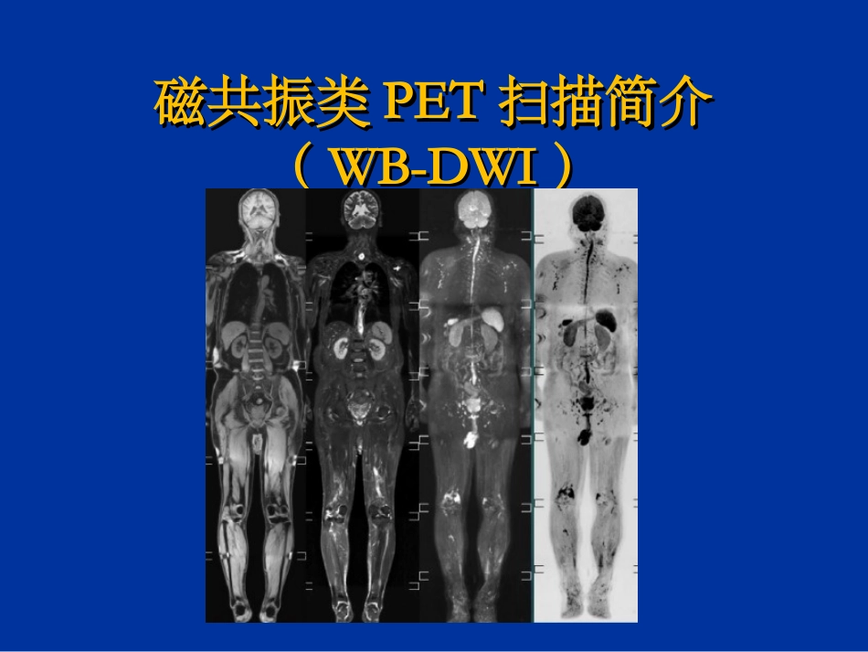 磁共振类PET扫描简介_第1页