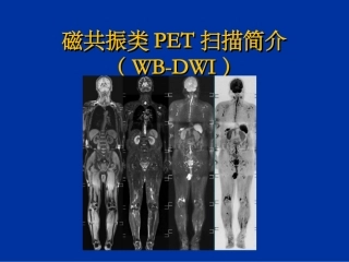 磁共振类PET扫描简介