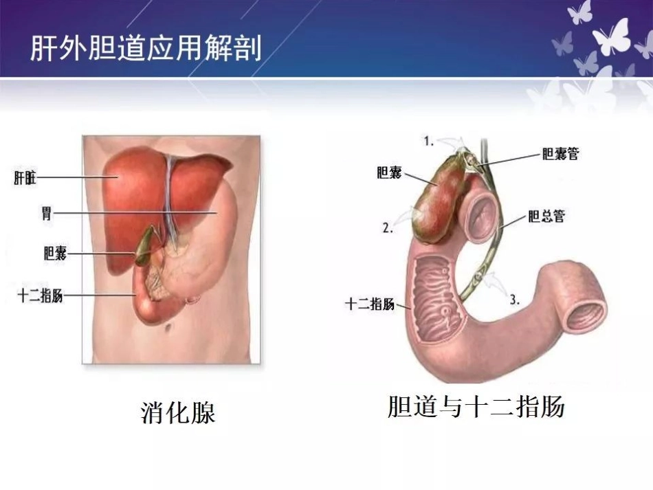 胆囊切除术的护理查房_第2页