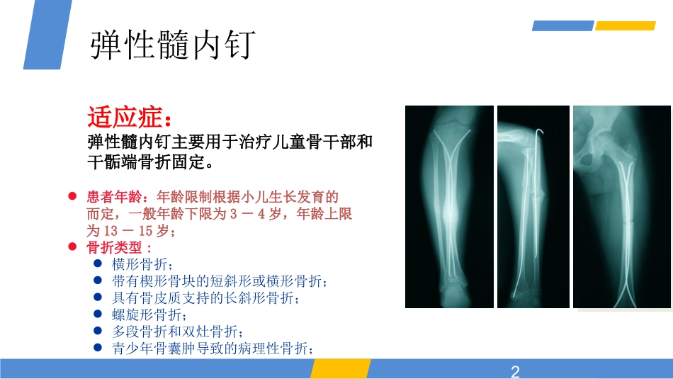 弹性髓内钉新版本_第2页