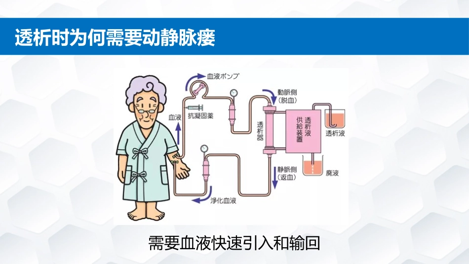 动静脉内瘘的护理常规_第3页