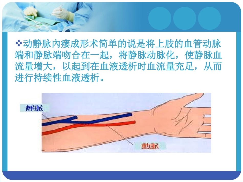动静脉内瘘护理查房_第2页