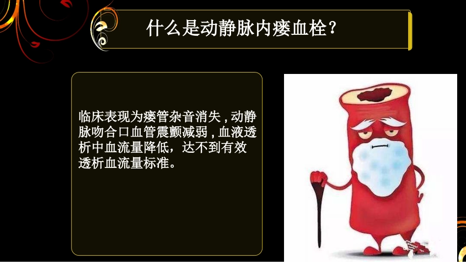 动静脉内瘘血栓_第3页