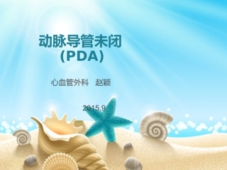 动脉导管未闭详解