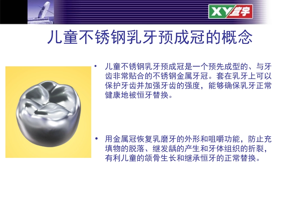 儿童不锈钢乳牙预成冠_第2页