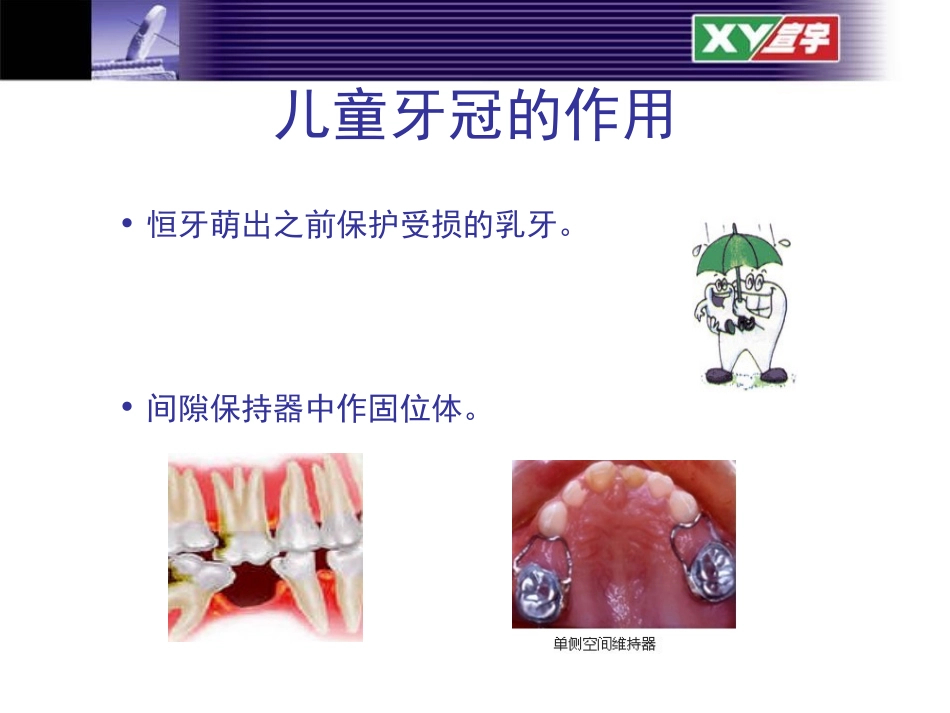 儿童不锈钢乳牙预成冠_第3页