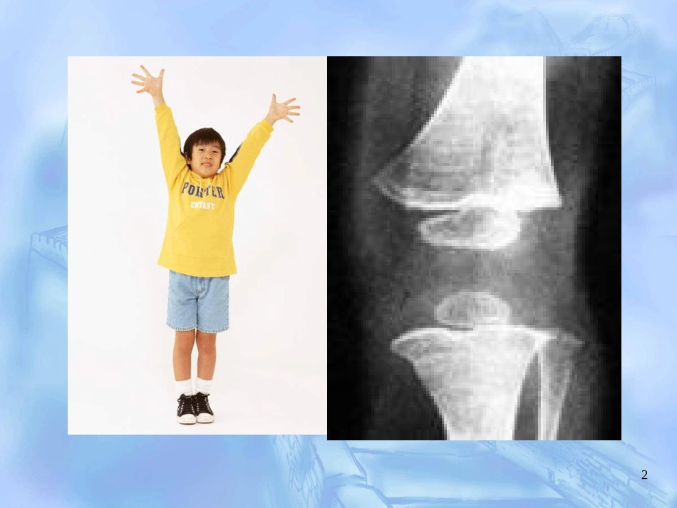 儿童骨骼生长及损伤特点_第2页