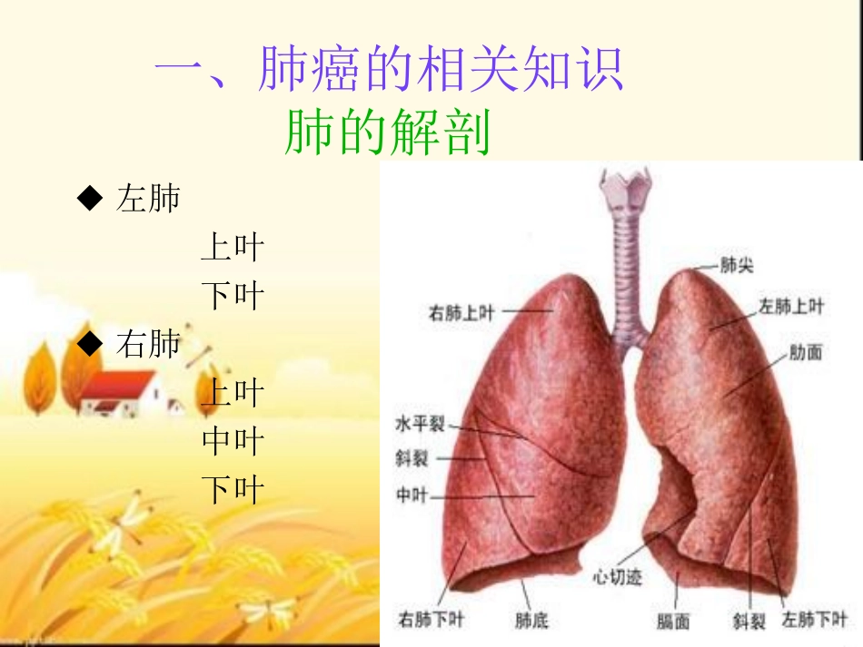 肺癌的护理查房课件_第3页