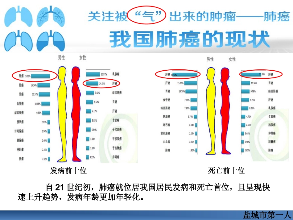 肺癌的围手术期护理_第2页
