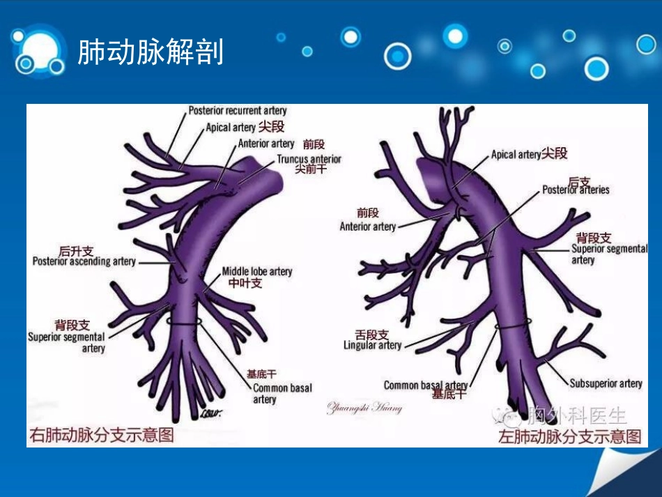 肺动脉CT血管造影技术CTPA_第3页