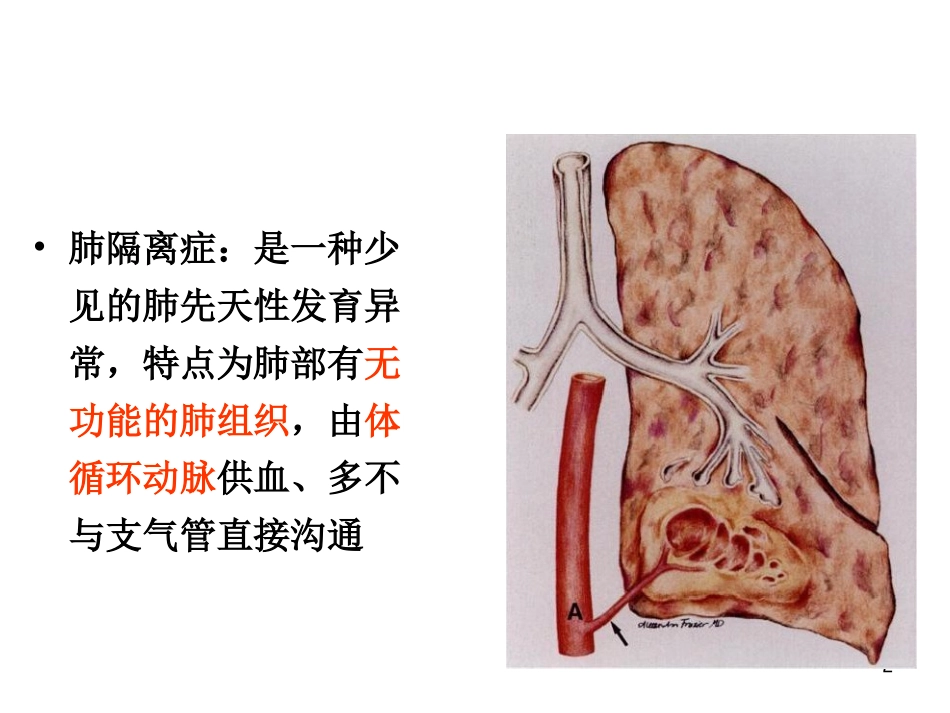 肺隔离症的影像表现_第2页
