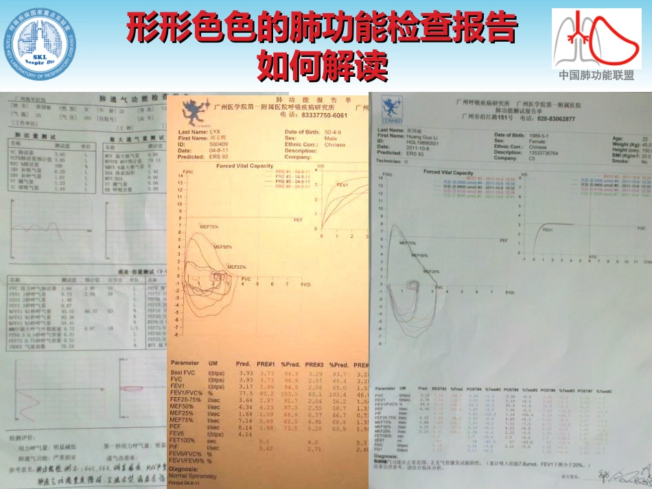 肺功能报告解读_第2页