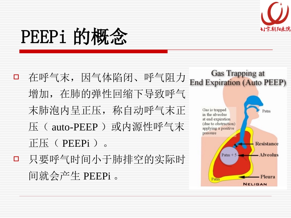 肺过度充气和PEEPigood_第3页