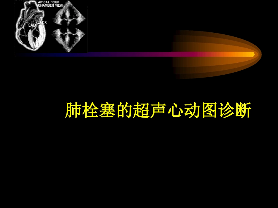 肺栓塞的超声心动图诊疗_第1页