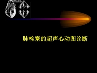 肺栓塞的超声心动图诊疗