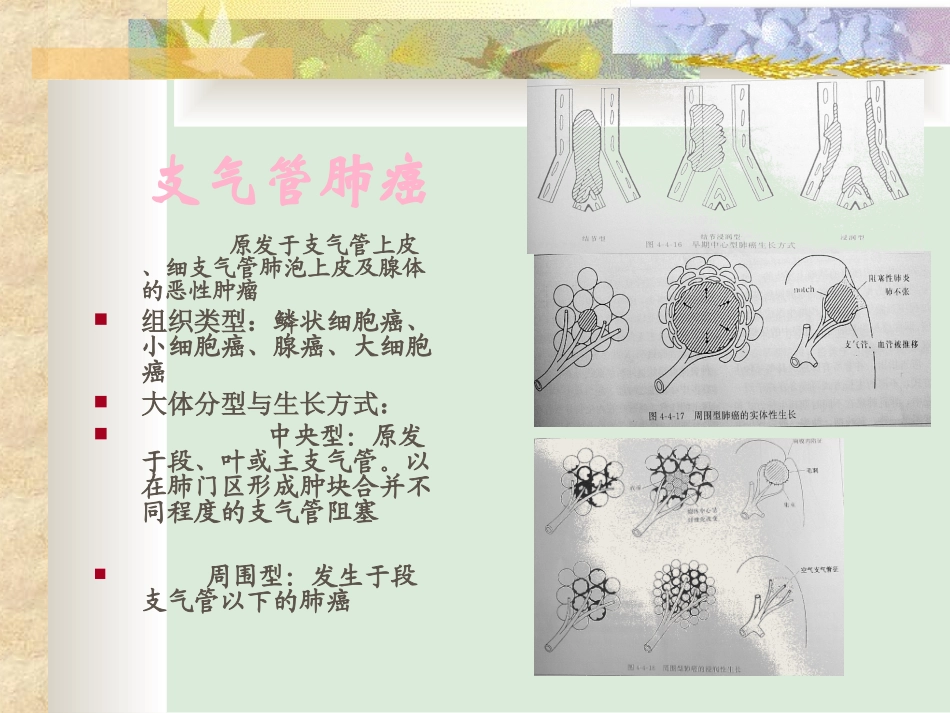 肺肿瘤影像诊疗_第3页