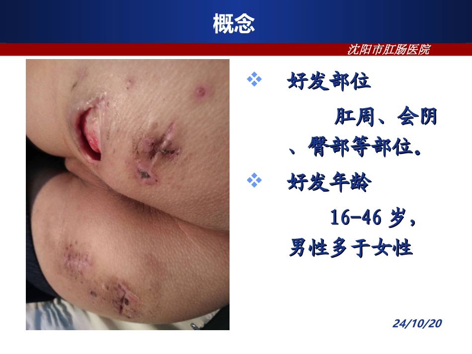 肛周慢性化脓性汗腺炎的诊疗和治疗_第3页