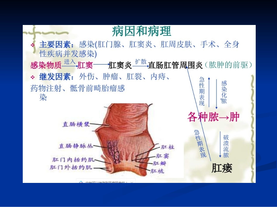 肛周脓肿超声诊疗_第3页