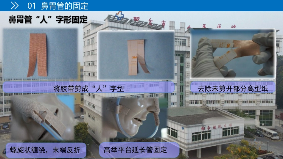 各种常见留置管道的固定方法及注意事项_第3页