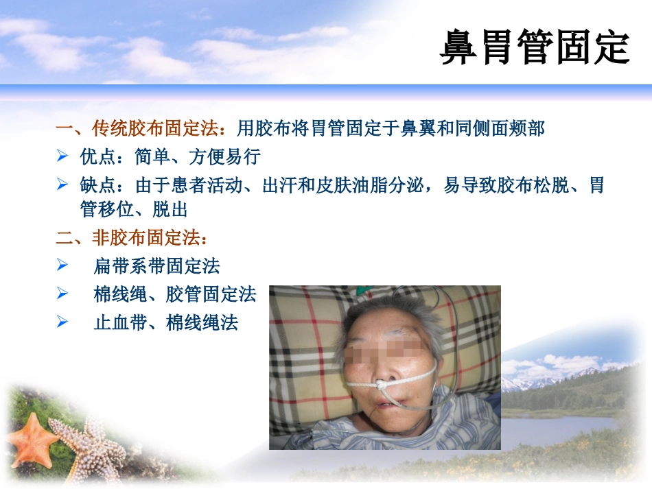 各种导管的固定_第3页