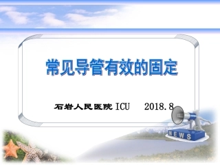 各种导管的固定