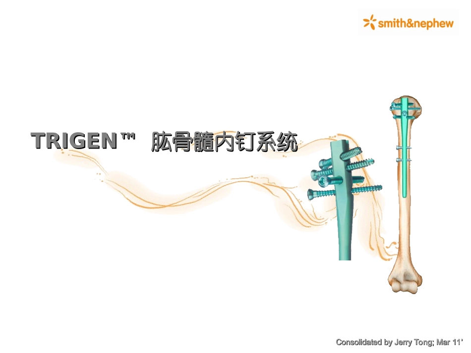 肱骨近端髓内钉_第1页