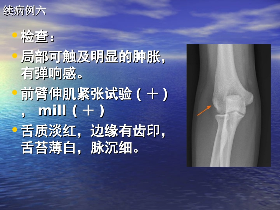 肱骨外上髁炎骨伤_第2页