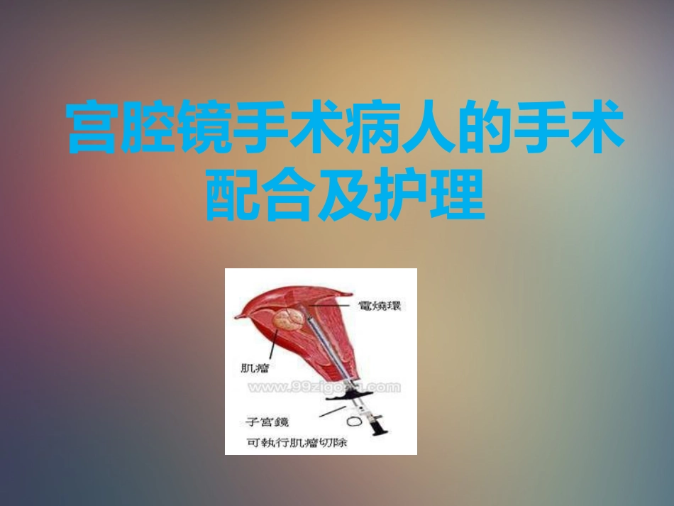 宫腔镜手术病人的手术配合和护理_第1页