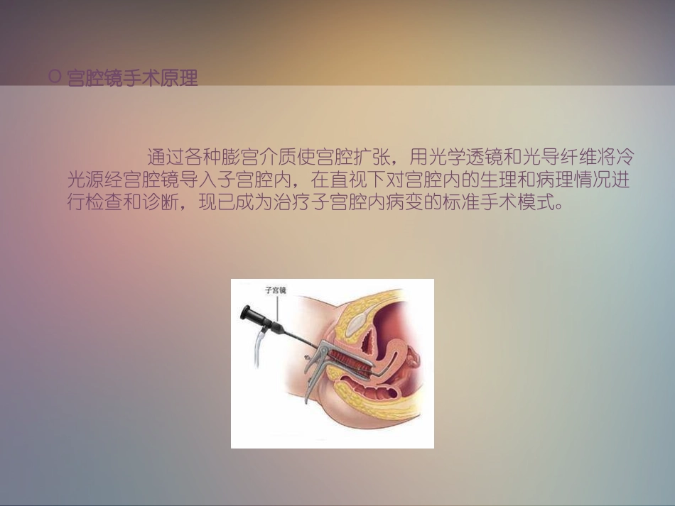 宫腔镜手术病人的手术配合和护理_第2页