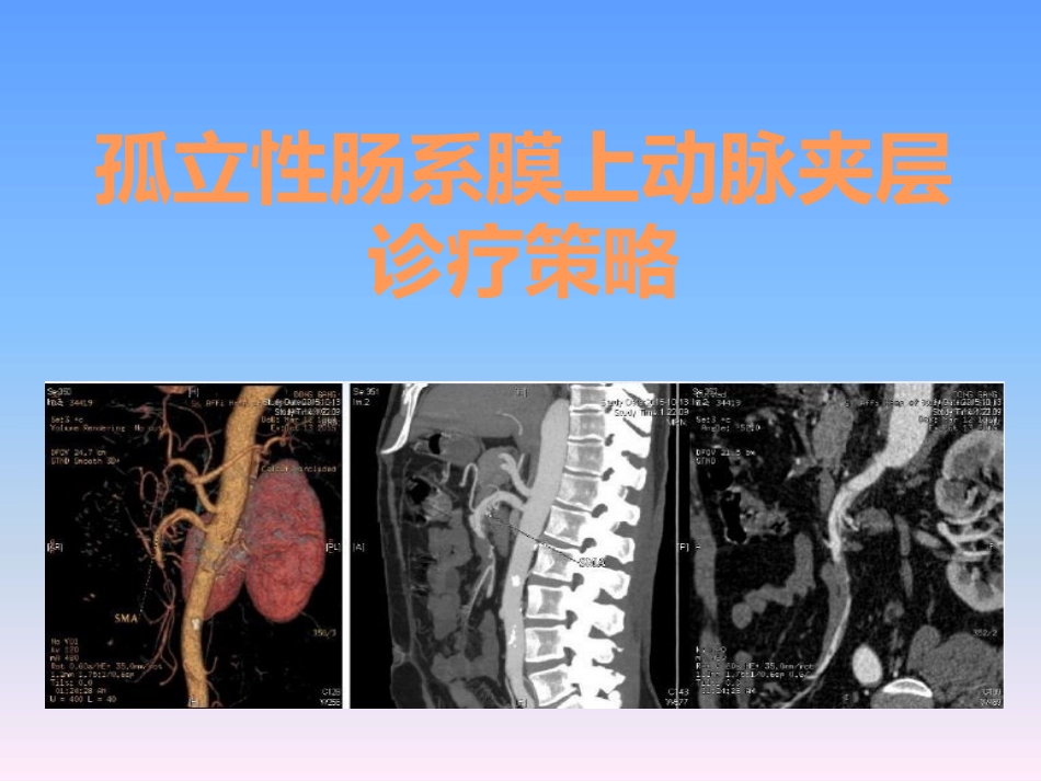 孤立性肠系膜上动脉夹层诊疗策略_第1页